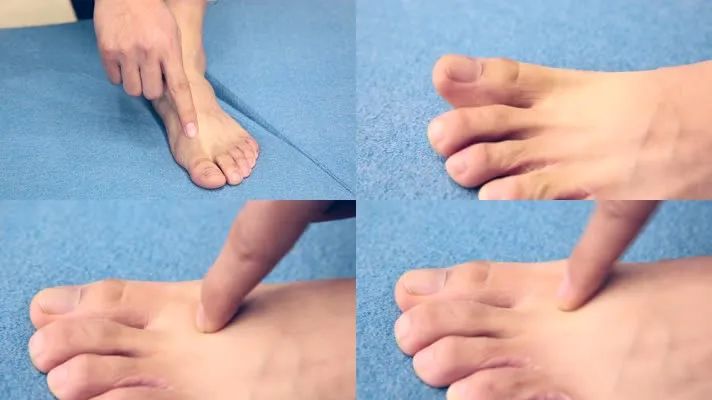 21 按摩太冲穴穴位按摩中医穴位太冲穴 视频素材,其它视频素材下载,高清3840X2160视频素材下载,凌点视频素材网,编号:366477