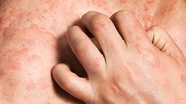 痒痛魔咒破解！